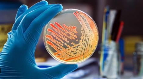 MICROBIOLOGIE